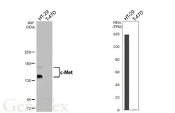 Anti-c-Met antibody [HL5899] used in Western Blot (WB). GTX647223