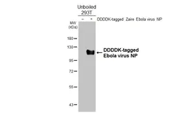 Anti-Ebola virus NP antibody [GT390] used in Western Blot (WB). GTX647231