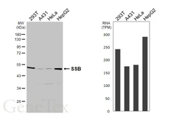 Anti-SSB antibody [HL5907] used in Western Blot (WB). GTX647232