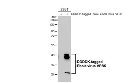 Anti-Ebola virus VP35 antibody [HL5918] used in Western Blot (WB). GTX647243