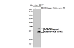 Anti-Rabies virus Matrix antibody [HL5925] used in Western Blot (WB). GTX647250