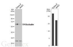 Anti-Occludin antibody [HL5934] used in Western Blot (WB). GTX647259