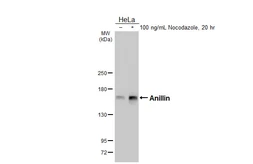 Anti-Anillin antibody [HL5958] used in Western Blot (WB). GTX647570