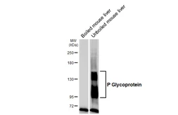 Anti-P Glycoprotein antibody [GT391] used in Western Blot (WB). GTX647572