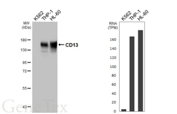 Anti-CD13 antibody [HL5966] used in Western Blot (WB). GTX647580
