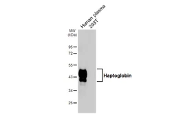 Anti-Haptoglobin antibody [HL5969] used in Western Blot (WB). GTX647583
