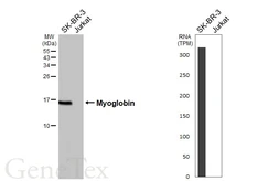 Anti-Myoglobin antibody [HL5977] used in Western Blot (WB). GTX647591