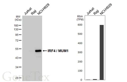 Anti-IRF4 / MUM1 antibody [HL5982] used in Western Blot (WB). GTX647596