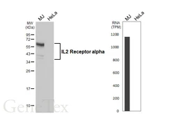 Anti-IL2 Receptor alpha antibody [HL5991] used in Western Blot (WB). GTX647605