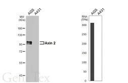 Anti-Axin 2 antibody [HL5994] used in Western Blot (WB). GTX647608