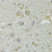Anti-CRYM antibody used in IHC (Paraffin sections) (IHC-P). GTX64761