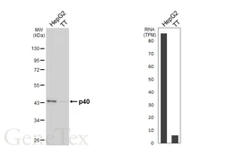 Anti-p40 antibody [HL6013] used in Western Blot (WB). GTX648087