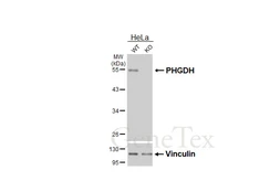 Anti-PHGDH antibody [HL6028] used in Western Blot (WB). GTX648102