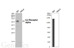 Anti-IL2 Receptor alpha antibody [HL6029] used in Western Blot (WB). GTX648103