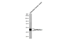 Anti-GPR37L1 antibody [HL6062] used in Western Blot (WB). GTX648141