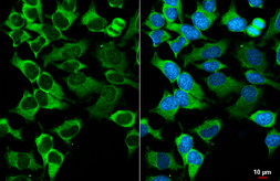 Anti-Aldolase A antibody [HL6082] used in Immunocytochemistry/ Immunofluorescence (ICC/IF). GTX648161
