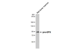 Anti-EPX antibody [HL6084] used in Western Blot (WB). GTX648163