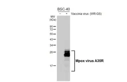 Anti-Mpox virus A35R antibody [GT401] used in Western Blot (WB). GTX648166