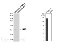 Anti-NTR1 antibody [HL6102] used in Western Blot (WB). GTX648187