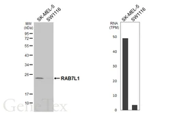 Anti-RAB7L1 antibody [HL6105] used in Western Blot (WB). GTX648190