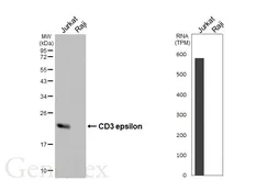 Anti-CD3 epsilon antibody [HL6121] used in Western Blot (WB). GTX648206