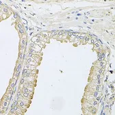 Anti-ANKH antibody used in IHC (Paraffin sections) (IHC-P). GTX64821