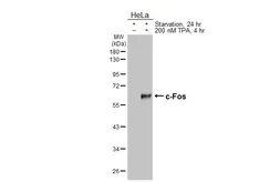 Anti-c-Fos antibody [HL6157] used in Western Blot (WB). GTX648244