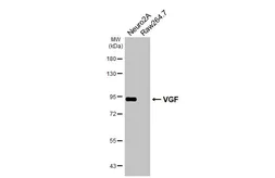 Anti-VGF antibody [HL6160] used in Western Blot (WB). GTX648247