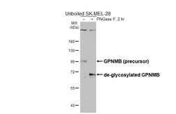 Anti-GPNMB antibody [HL6170] used in Western Blot (WB). GTX648257