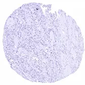Anti-FOXA1 antibody [HMV4726] HistoMAX&trade; used in IHC (Paraffin sections) (IHC-P). GTX648263