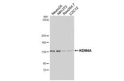 Anti-KDM4A antibody [HL6180] used in Western Blot (WB). GTX648272