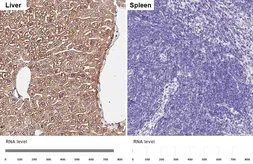 Anti-Aldolase B antibody [HL6238] used in IHC (Paraffin sections) (IHC-P). GTX648330