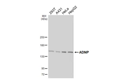 Anti-ADNP antibody [HL6241] used in Western Blot (WB). GTX648333