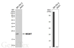 Anti-MGMT antibody [HL6254] used in Western Blot (WB). GTX648346