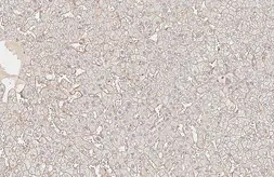 Anti-CD81 antibody [HL6288] used in IHC (Paraffin sections) (IHC-P). GTX648390