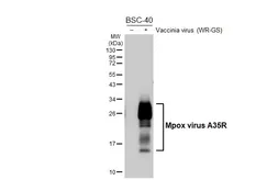 Anti-Mpox virus A35R antibody [HL6293] used in Western Blot (WB). GTX648395