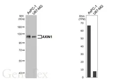Anti-AXIN1 antibody [HL6296] used in Western Blot (WB). GTX648398