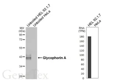 Anti-Glycophorin A antibody [HL6300] used in Western Blot (WB). GTX648402