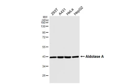 Anti-Aldolase A antibody [HL6304] used in Western Blot (WB). GTX648406