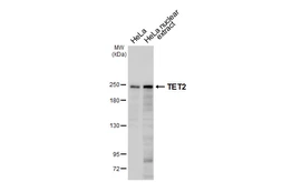 Anti-TET2 antibody [HL6324] used in Western Blot (WB). GTX648434