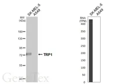 Anti-TRP1 antibody [HL6342] used in Western Blot (WB). GTX648452