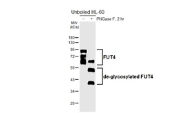 Anti-FUT4 antibody [HL6347] used in Western Blot (WB). GTX648457