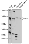 Anti-Inversin antibody used in Western Blot (WB). GTX64870