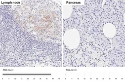 Anti-CD23 antibody [GT413] used in IHC (Paraffin sections) (IHC-P). GTX648783