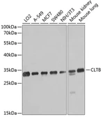 Anti-CLTB antibody used in Western Blot (WB). GTX64881