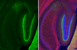 Anti-Calretinin antibody [HL6380] used in IHC (Paraffin sections) (IHC-P). GTX648819