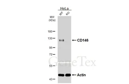 Anti-CD146 antibody [HL6385] used in Western Blot (WB). GTX648824