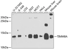 Anti-TIMM8A antibody used in Western Blot (WB). GTX64883