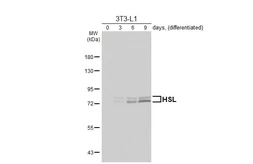 Anti-HSL antibody [HL6391] used in Western Blot (WB). GTX648830