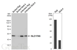 Anti-SLC17A5 antibody [HL6399] used in Western Blot (WB). GTX648844